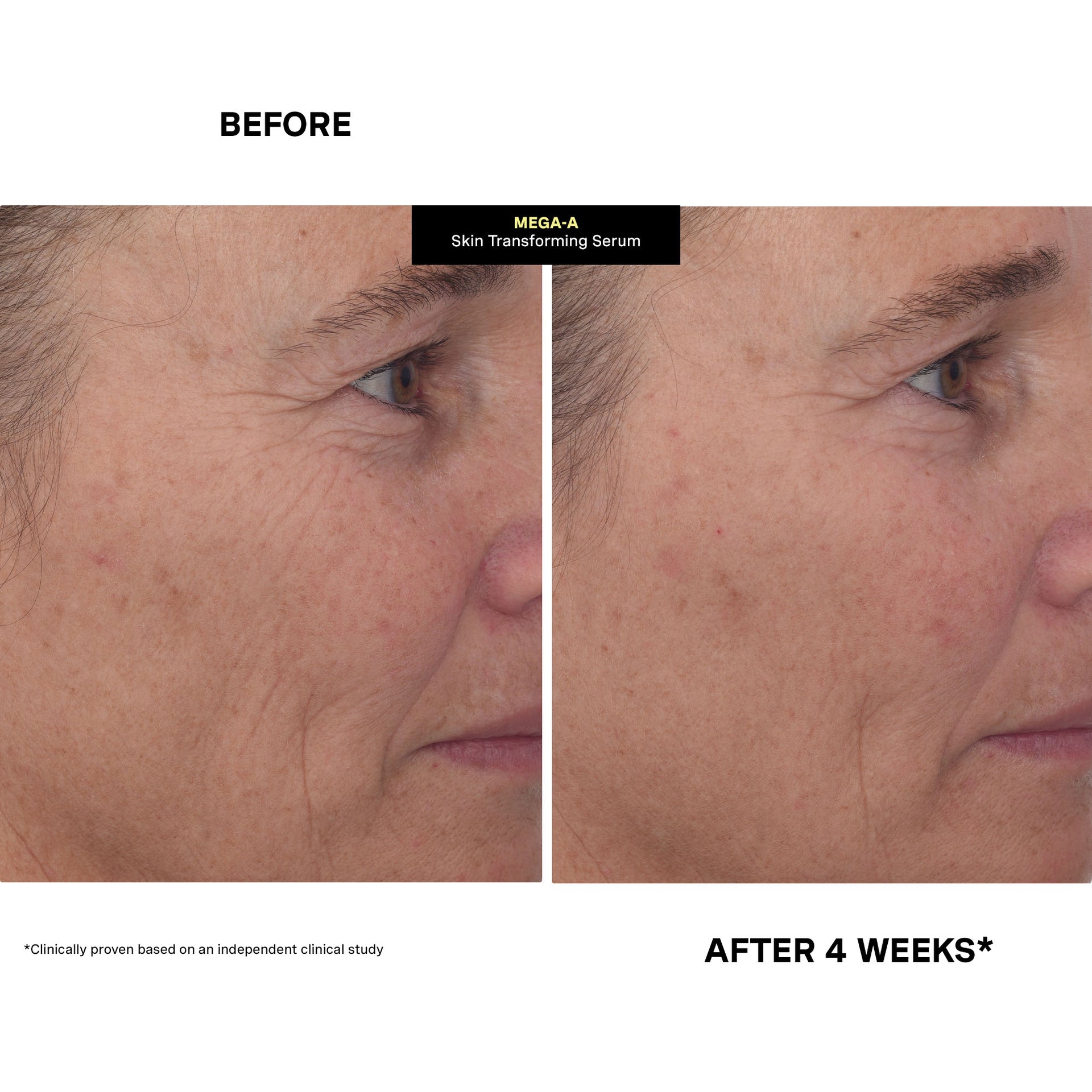 Mega-A™ Skin Transforming Serum